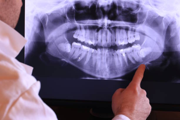Best Urgent Care for Lost Fillings or Crowns in Saxonburg, PA